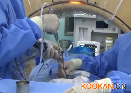 水木天蓬超聲骨刀，把手術變簡單，把時間還給醫生